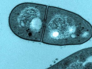 Mycobacterium spongiae под микроскопом. Фото: Pidot and team at the Doherty Institute