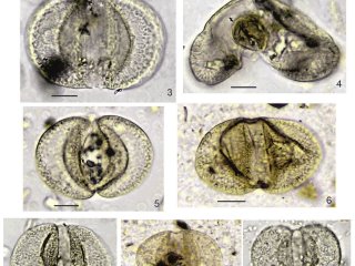 Образцы пыльцы под микроскопом. Фото предоставлено исследователями ИНГГ СО РАН