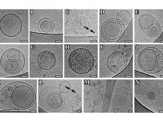 Впервые в мире проведена криоэлектронная микроскопия экзосом спинномозговой жидкости человека