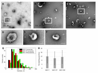 Экзосомы. Источник фото: пресс-служба НМИЦ онкологии им. Блохина