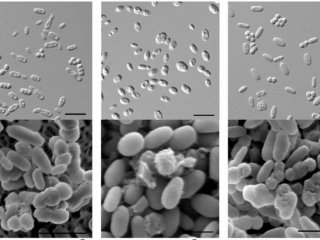 Ученые установили принадлежность трех новых видов дрожжей к редкому роду Vanderwaltozyma
