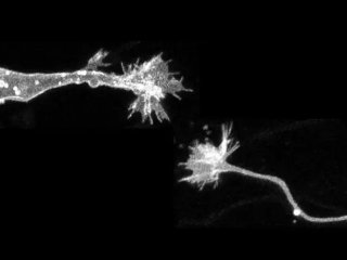 Покадровые изображения мигрирующего нейрона (слева) и удлиняющегося аксона (справа), полученные с помощью микроскопии со сверхвысоким разрешением. Ростовые конусы на кончиках нейронов расширяются по мере миграции тела клетки и удлинения аксона