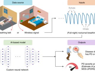 Искусственный интеллект научилcя определять болезнь Паркинсона по дыханию