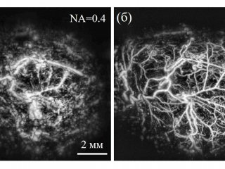 Оптоакустические изображения сосудистой сети опухоли SN-12C, полученные с помощью (а) детектора с низкой числовой апертурой 0.4, (б) детектора со сверхвысокой числовой апертурой 0.9. Источник - ИПФ РАН